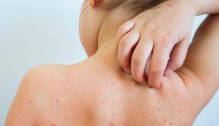 Okullarda su&ccedil;i&ccedil;eği alarmı! Veliler tedirgin: Bu belirtiler varsa dikkat