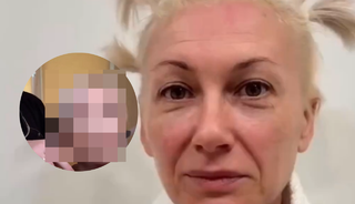 Estetikle 20 yaş gen&ccedil;leşti! Yaşlı kadının değişimini g&ouml;renler inanamadı