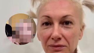 Estetikle 20 yaş gençleşti! Yaşlı kadının değişimini görenler inanamadı