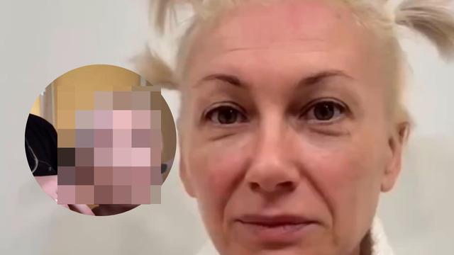 Estetikle 20 yaş gençleşti! Yaşlı kadının değişimini görenler inanamadı