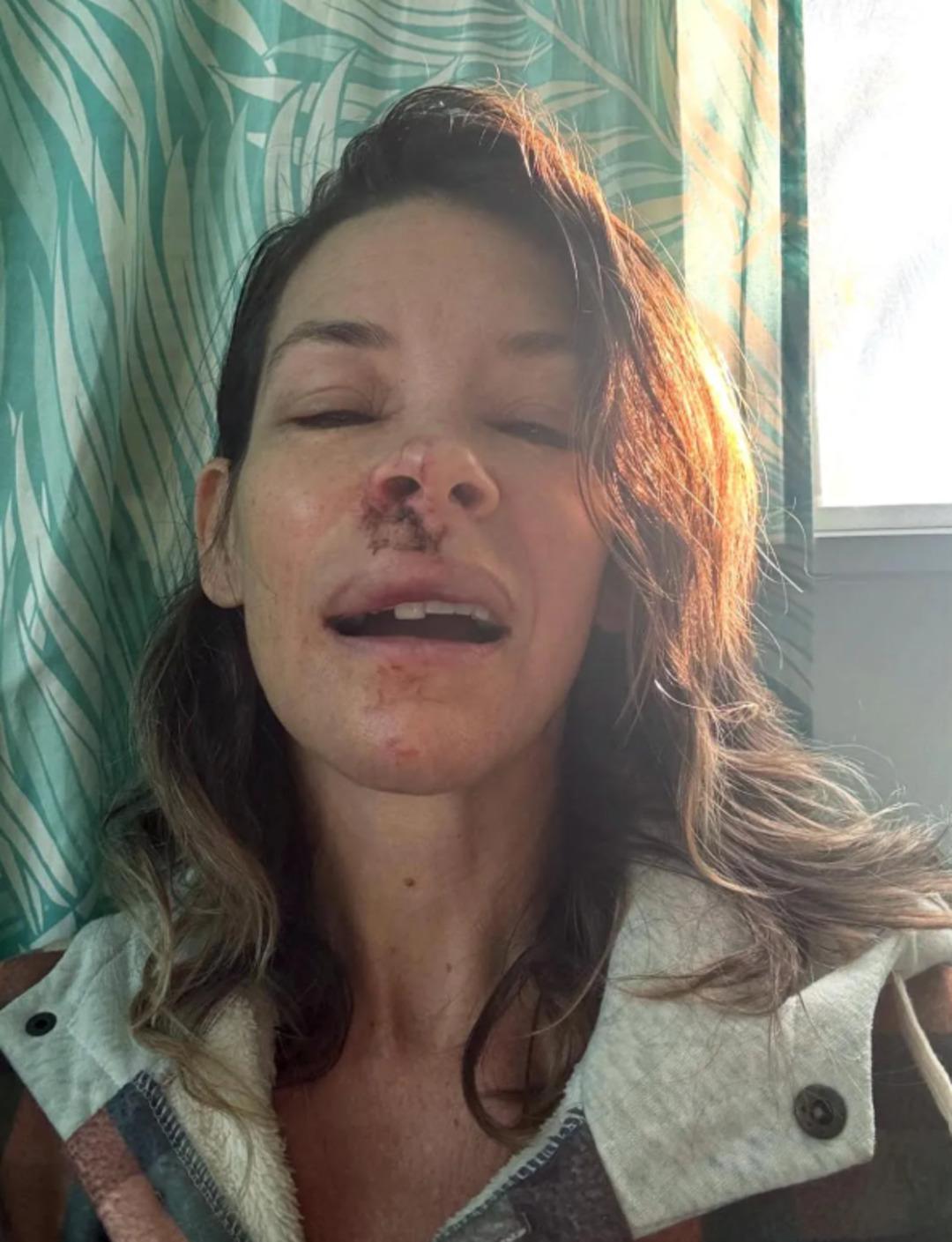 Ünlü Marvel yıldızından korkunç kaza: Kayanın üstüne düştü! 