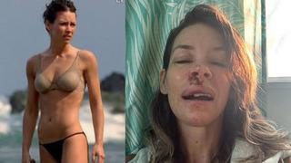 Ünlü Marvel yıldızından korkunç kaza: Kayanın üstüne düştü! Ağzım kan içinde kaldı