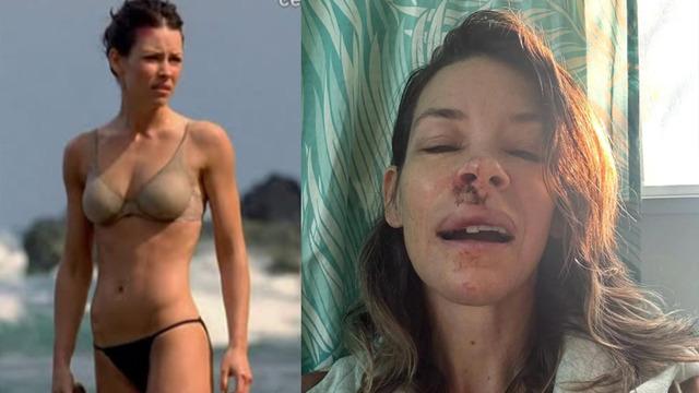 Ünlü Marvel yıldızından korkunç kaza: Kayanın üstüne düştü! Ağzım kan içinde kaldı