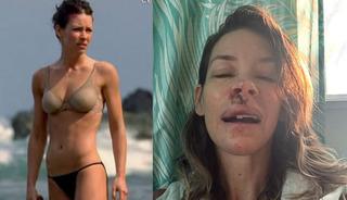 Marvel yıldızının &uuml;st&uuml;ne kaya d&uuml;şt&uuml;!