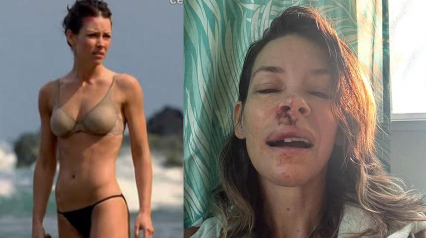 &Uuml;nl&uuml; Marvel yıldızından korkun&ccedil; kaza: Kayanın &uuml;st&uuml;ne d&uuml;şt&uuml;! "Ağzım kan i&ccedil;inde kaldı"