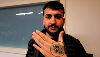 G&uuml;zellik merkezine gitti, elini kaybediyordu! 