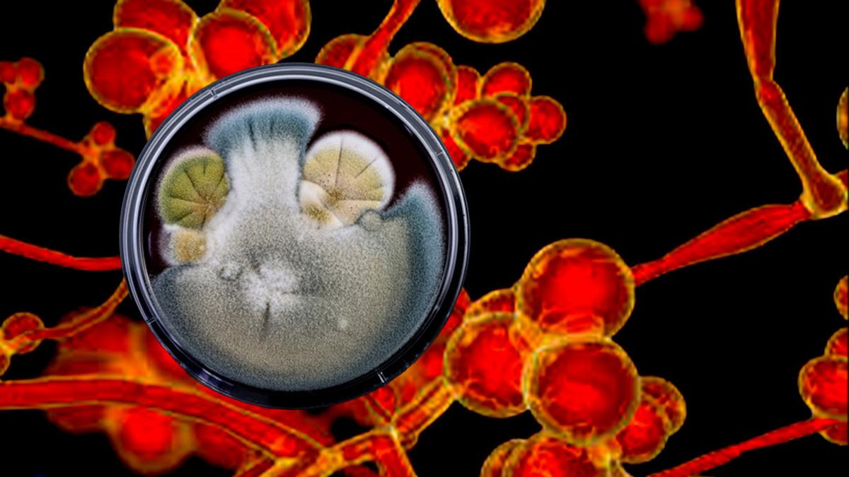 ABD alarm verdi 60 ülkede görüldü: İlaçlar bile çözüm olmuyor! Ölümcül mantar hastalığı korku saçıyor - Sağlık Haberleri