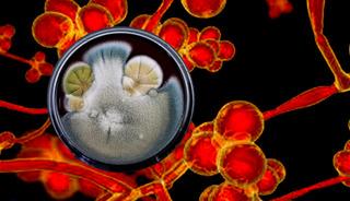 ABD alarm verdi 60 &uuml;lkede g&ouml;r&uuml;ld&uuml;: İla&ccedil;lar bile &ccedil;&ouml;z&uuml;m olmuyor!