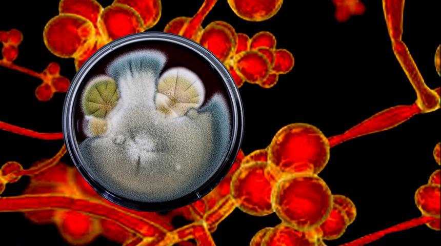 ABD alarm verdi 60 &uuml;lkede g&ouml;r&uuml;ld&uuml;: İla&ccedil;lar bile &ccedil;&ouml;z&uuml;m olmuyor! &Ouml;l&uuml;mc&uuml;l mantar hastalığı korku sa&ccedil;ıyor