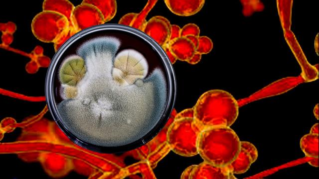 ABD alarm verdi 60 ülkede görüldü: İlaçlar bile çözüm olmuyor! Ölümcül mantar hastalığı korku saçıyor