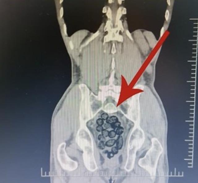 Batman’da yabancı uyruklu bir şahsın midesinden 64 parça uyuşturucu çıktı 4