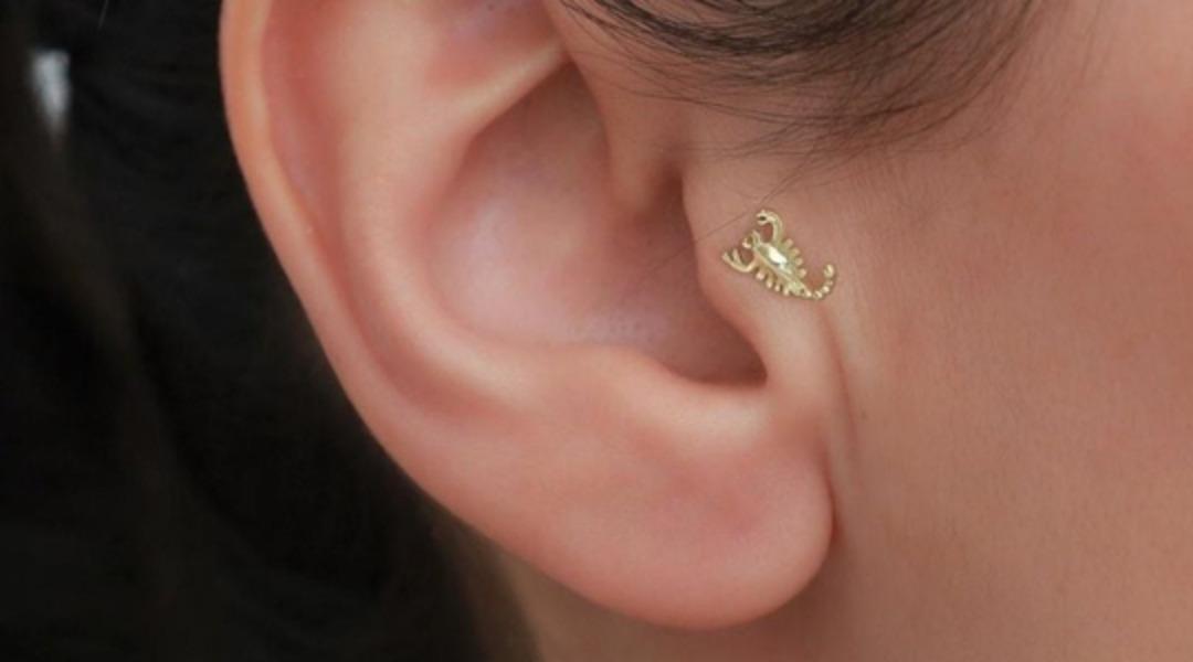 MYNET &Ouml;ZEL | Piercing kabusu: 8 yıl sonra kulağı ikiye ayrıldı!  1