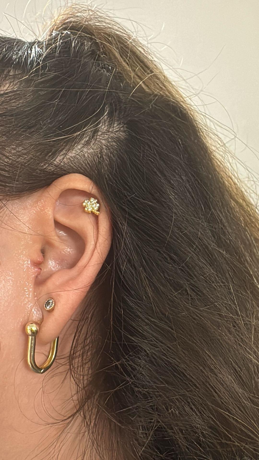 MYNET &Ouml;ZEL | Piercing kabusu: 8 yıl sonra kulağı ikiye ayrıldı!  2