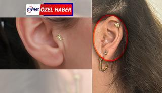 MYNET &Ouml;ZEL |Piercing kabusu: Kulağı ikiye ayrıldı! 