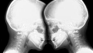 Ezber bozan deney! MR cihazında cinsel ilişkiye girdiler