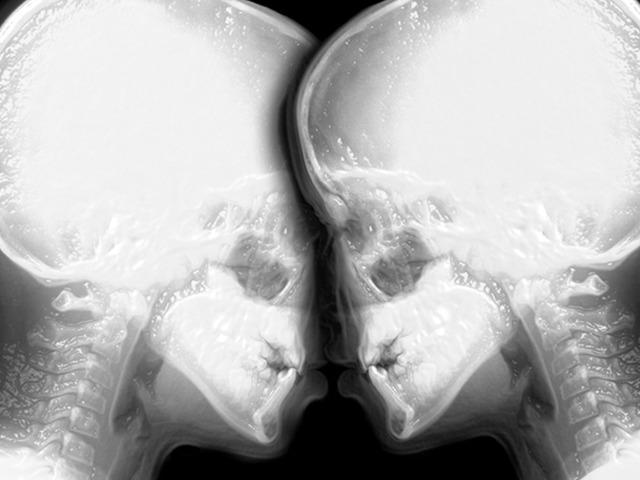 Ezber bozan deney! MR cihazında cinsel ilişkiye girdiler