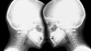 Ezber bozan deney! MR cihazında cinsel ilişkiye girdiler: Makalelere konu oldu