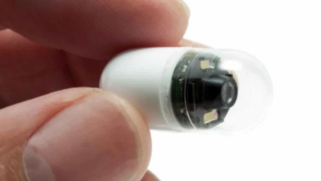 Kolonoskopi tarih oluyor! Akıllı hap sahnede: 20 dakikada rapor verecek