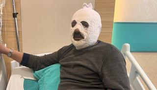 Kalorifer kazanını yakmak istedi, y&uuml;z&uuml;n&uuml; yaktı!