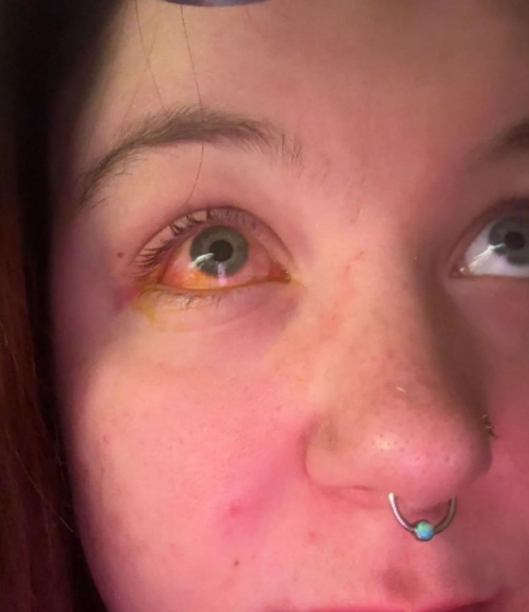 Yatmadan &ouml;nce &ccedil;amaşır yıkadı: Sabah uyandığında k&ouml;r olmuştu! 4