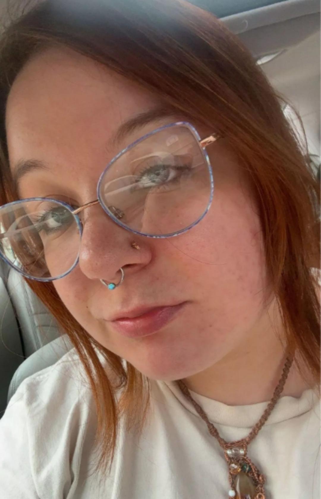 Yatmadan &ouml;nce &ccedil;amaşır yıkadı: Sabah uyandığında k&ouml;r olmuştu! 5