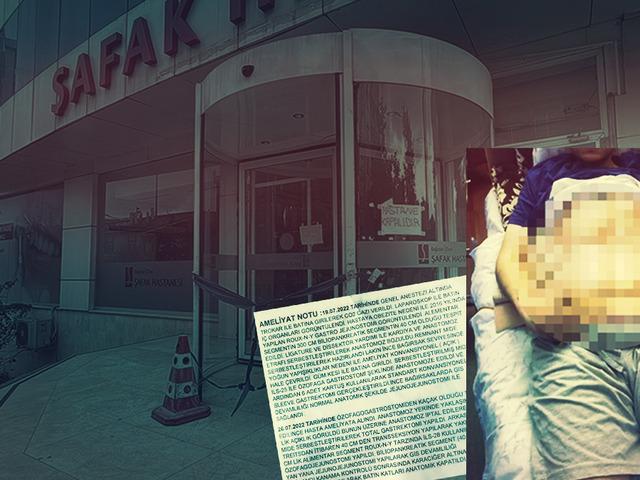 Ameliyatta midesini alıp &ccedil;&ouml;pe attılar, skandalda yeni perde