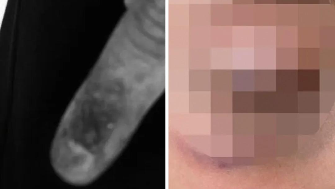 Akran zorbalığı bitmiyor! Darp edilen &ccedil;ocuğun fotoğrafını t&uuml;m okula yaymışlar 2