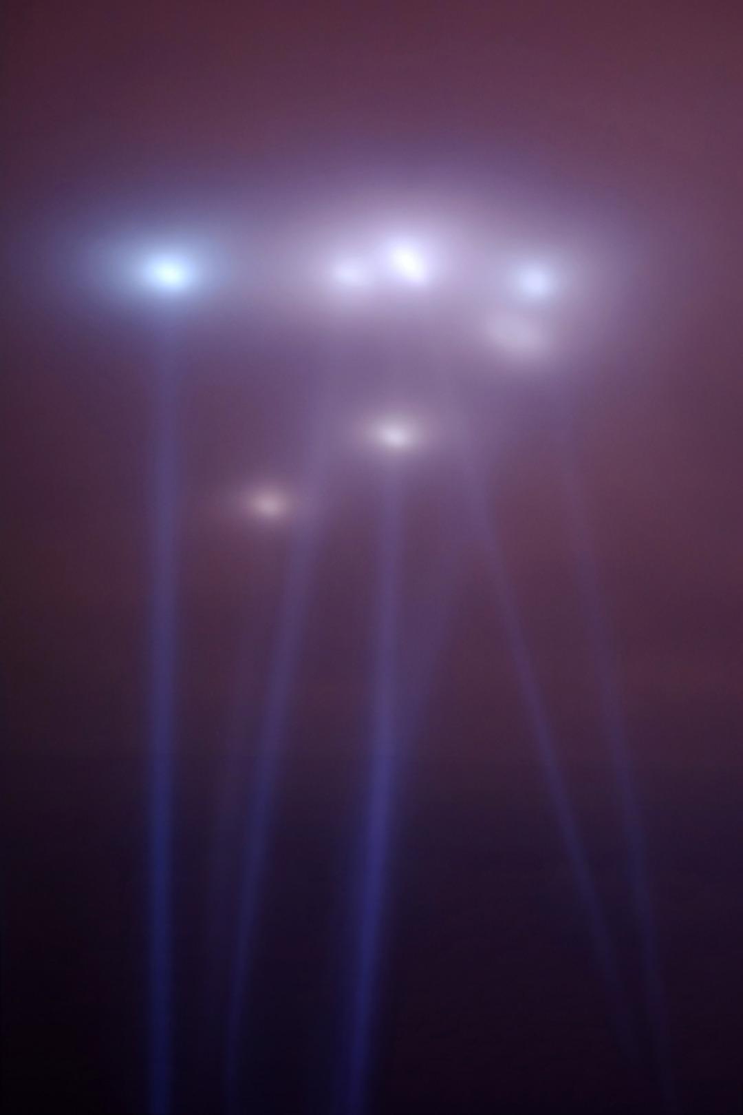 G&ouml;rd&uuml;kten sonra hayatı değişti: Mesleğini bile bıraktı! &ldquo;A&ccedil;ık mavi tenli ve sa&ccedil;sızdı" 3