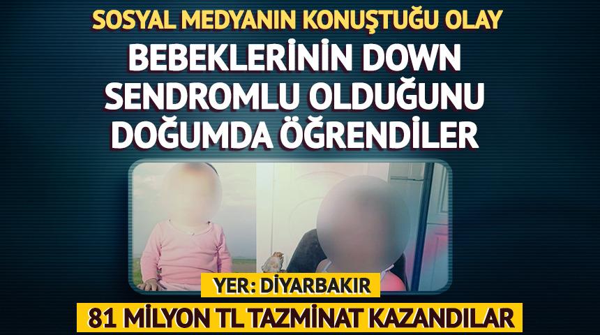 Bebeklerinin Down Sendromlu olduğunu doğumda &ouml;ğrenen aile 81 milyon TL tazminat kazandı