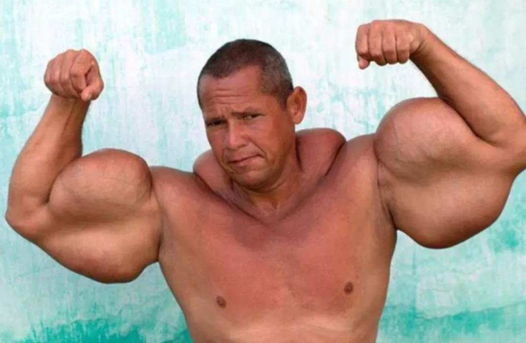 &ldquo;Temel Reis&rdquo; olarak anılıyordu: V&uuml;cuduna enjekte ettiği şey hayatından etti! 3