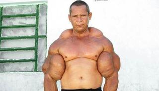 V&uuml;cuduna bakın ne enjekte etmiş: &ldquo;Temel Reis&rdquo; hayatını kaybetti