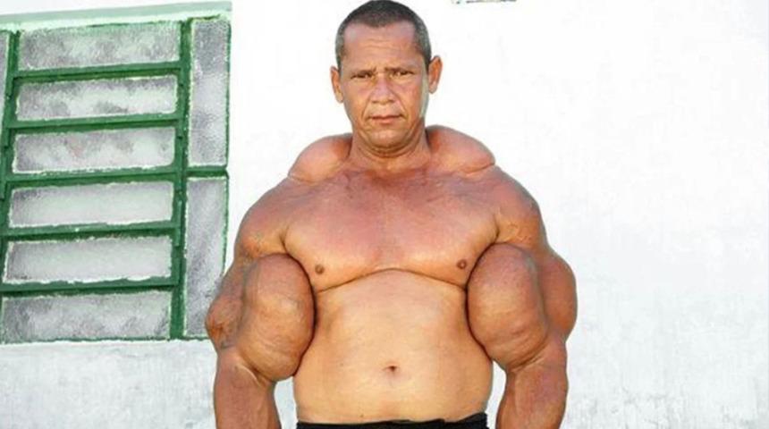 &ldquo;Temel Reis&rdquo; olarak anılıyordu: V&uuml;cuduna enjekte ettiği şey hayatından etti!