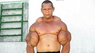 “Temel Reis” olarak anılıyordu: Vücuduna enjekte ettiği şey hayatından etti!