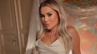 Değişimiyle g&uuml;ndemdeydi! Estetik itirafı şaşırttı 