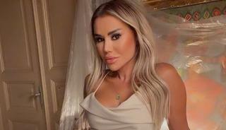 Değişimiyle g&uuml;ndemdeydi! Estetik itirafı şaşırttı 