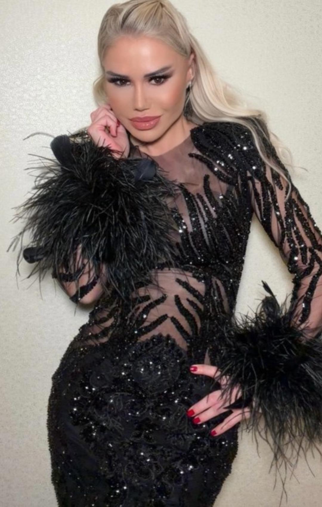 Değişimiyle g&uuml;ndemdeydi! Ceylan ın estetik itirafı şaşırttı  1