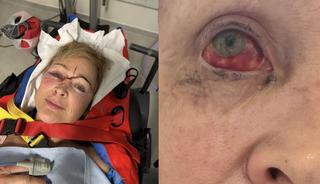 Sahibini b&ouml;yle ezdi: &Ouml;l&uuml;mden d&ouml;nd&uuml;!