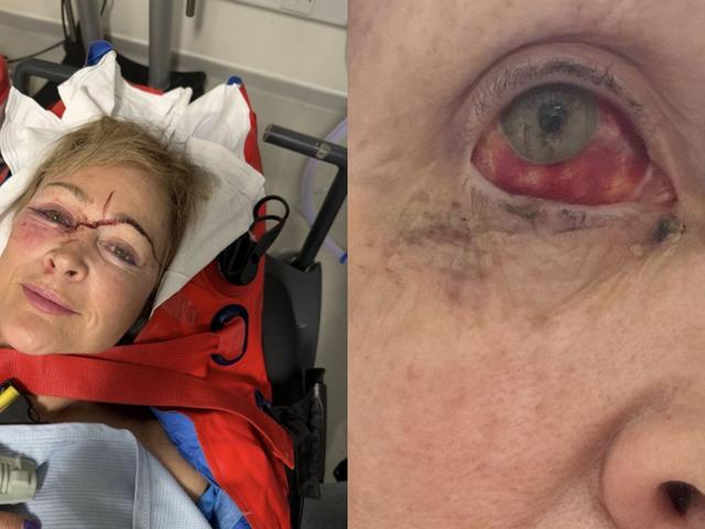 Sahibini b&ouml;yle ezdi: &Ouml;l&uuml;mden d&ouml;nd&uuml;!