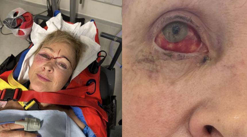 Bir g&uuml;vercin az kalsın canına mal oluyordu! Şampiyon binici &ouml;l&uuml;mden d&ouml;nd&uuml;