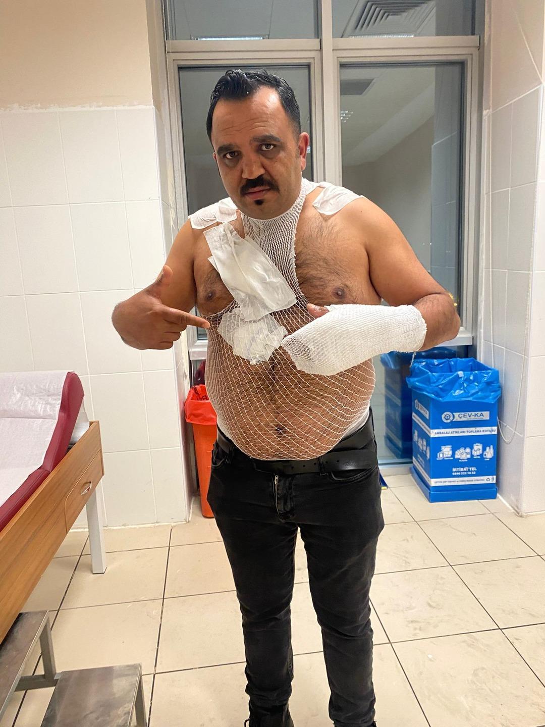 Sosyal medyanın &uuml;nl&uuml; tost&ccedil;usu cayır cayır yandı! Deneyin sonu k&ouml;t&uuml; biitti 2