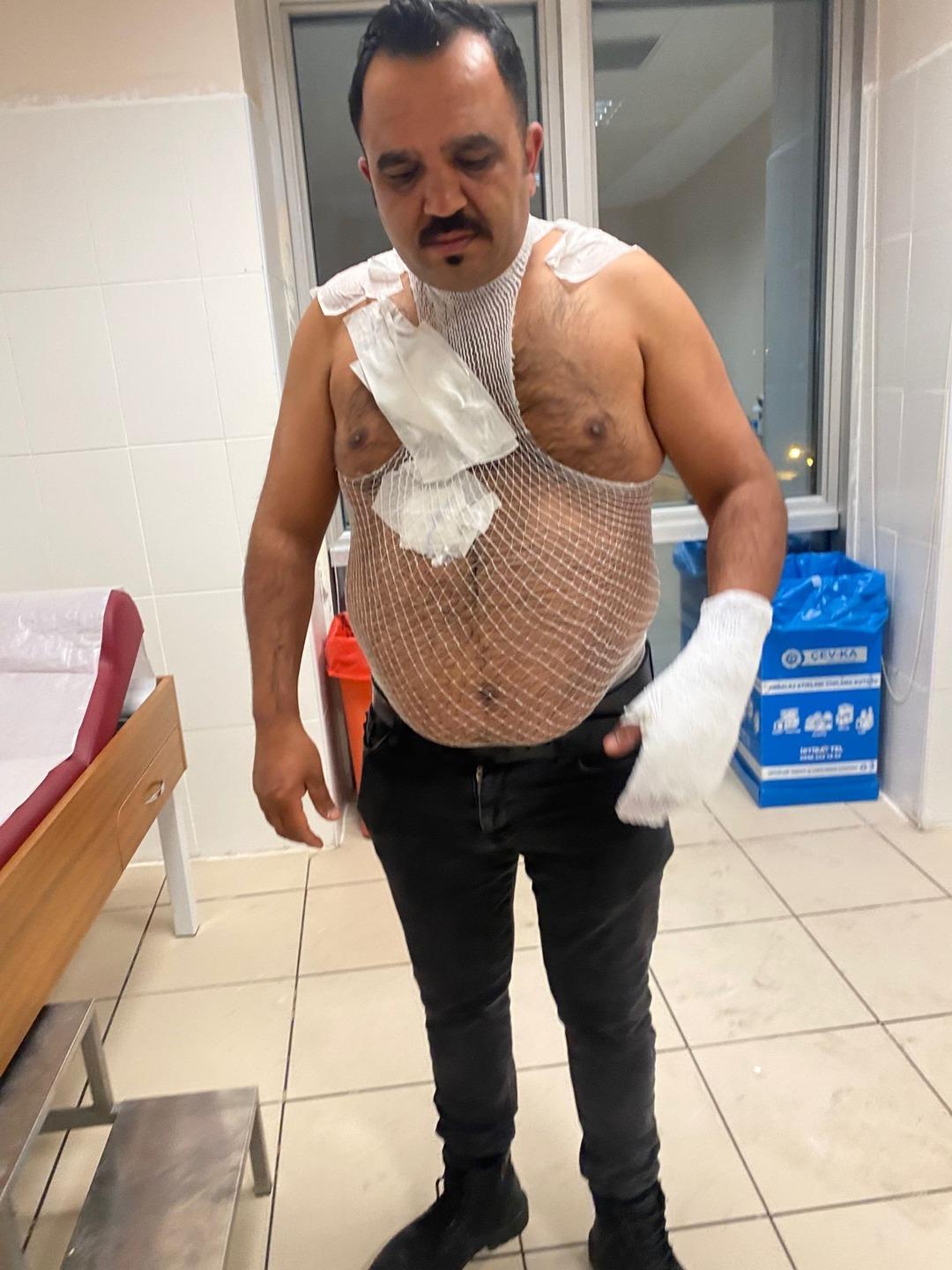 Sosyal medyanın &uuml;nl&uuml; tost&ccedil;usu cayır cayır yandı! Deneyin sonu k&ouml;t&uuml; biitti 3