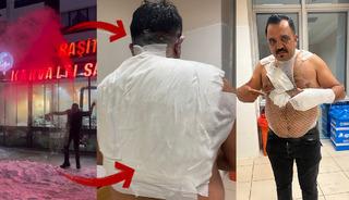 Sosyal medyanın &uuml;nl&uuml; tost&ccedil;usu cayır cayır yandı!