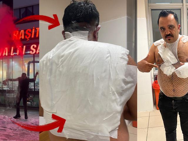 Sosyal medyanın &uuml;nl&uuml; tost&ccedil;usu cayır cayır yandı!