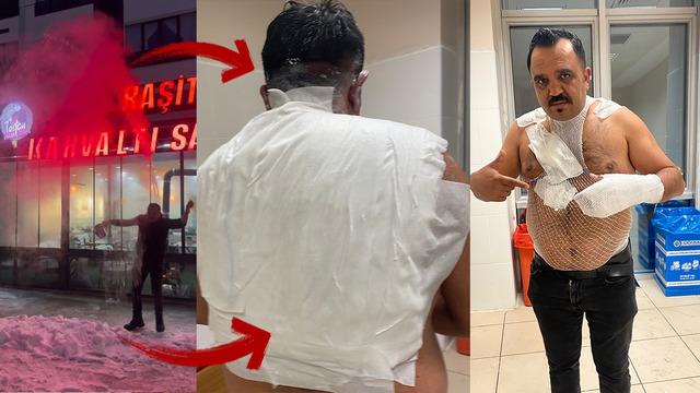 Sosyal medyanın ünlü tostçusu cayır cayır yandı! Deneyin sonu kötü biitti