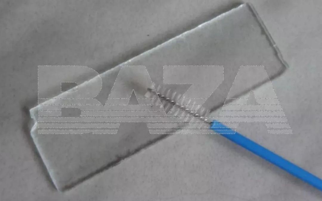 &Ouml;zel klinikte skandal ihmal! Doktor rahimde metal fır&ccedil;a unuttu 1