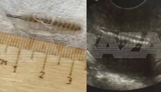 Kadın doğum muayenesinde akılalmaz hata!