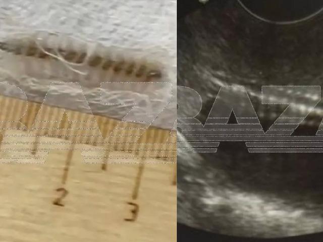 Kadın doğum muayenesinde akılalmaz hata!