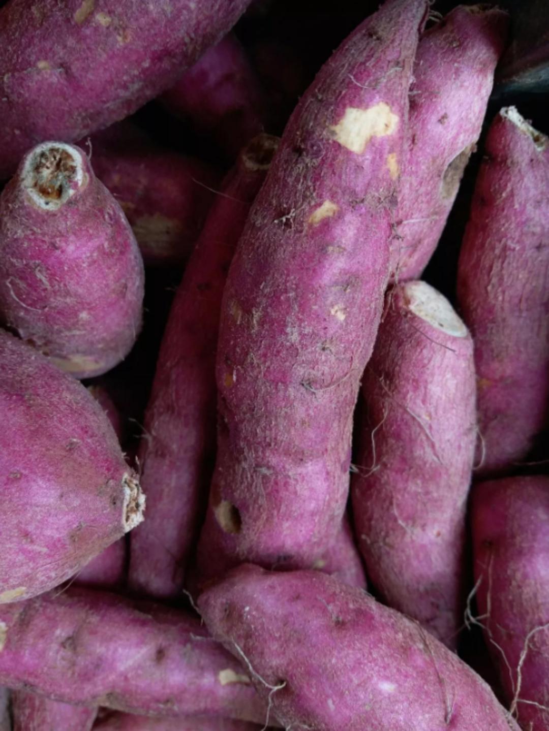 Doktorlar g&ouml;zlerine inanamadı! Makatından 17 santimlik patates &ccedil;ıktı 1