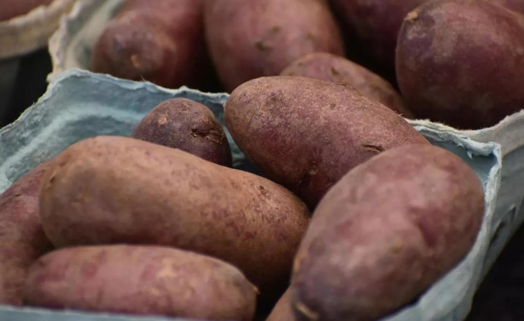 Doktorlar g&ouml;zlerine inanamadı! Makatından 17 santimlik patates &ccedil;ıktı 2