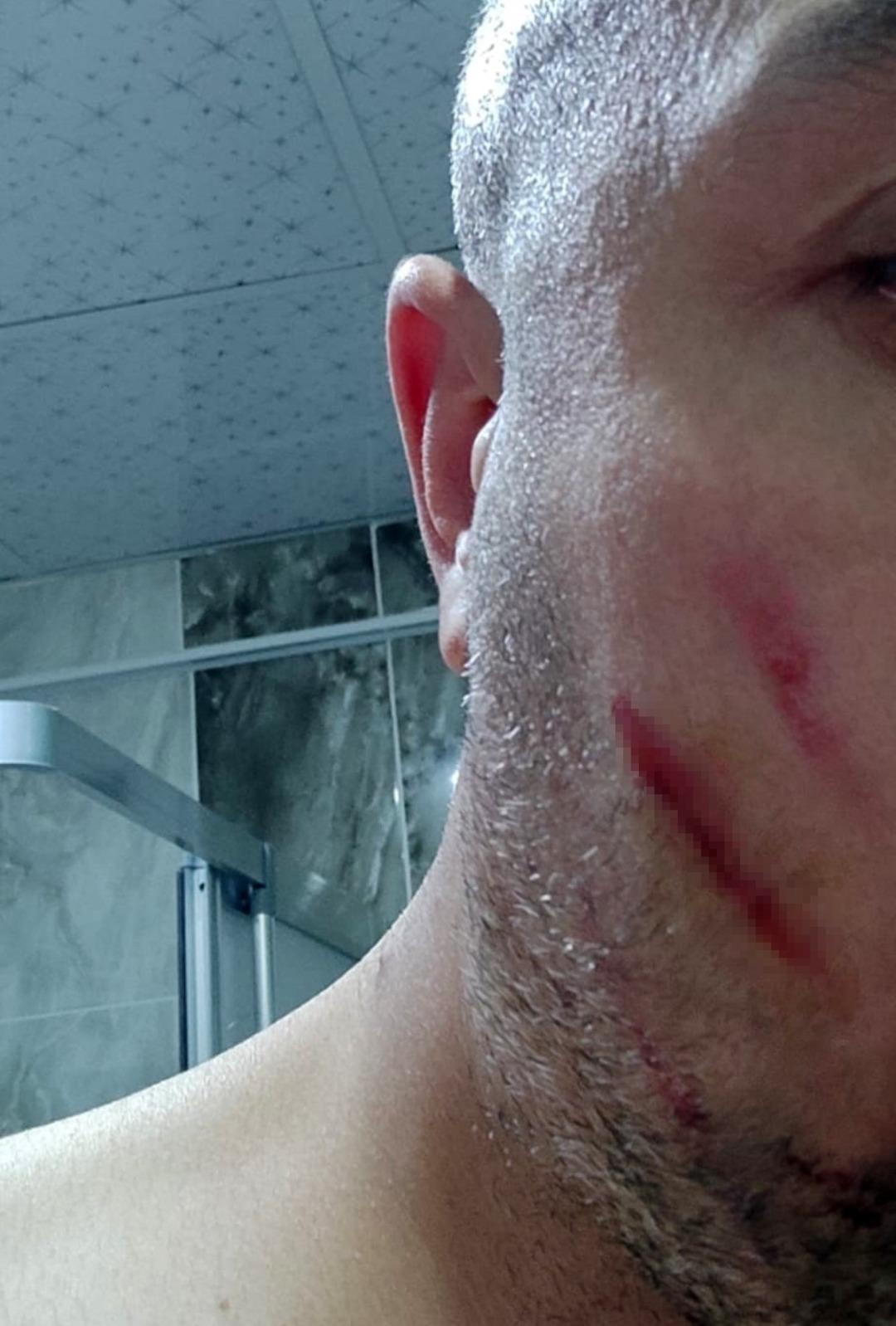 &ldquo;Yaptığınız ayıptır&rdquo; dedi, dayak yedi! Tuvaletini evin &ouml;n&uuml;nde yaptı, ortalık karıştı! 1